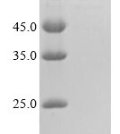 SDS-PAGE separation of QP5750 followed by commassie total protein stain results in a primary band consistent with reported data for CALR / Calreticulin. These data demonstrate Greater than 90% as determined by SDS-PAGE.