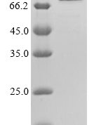 SDS-PAGE separation of QP5750 followed by commassie total protein stain results in a primary band consistent with reported data for CALR / Calreticulin. These data demonstrate Greater than 90% as determined by SDS-PAGE.