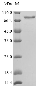 SDS-PAGE separation of QP5750 followed by commassie total protein stain results in a primary band consistent with reported data for CALR / Calreticulin. These data demonstrate Greater than 90% as determined by SDS-PAGE.