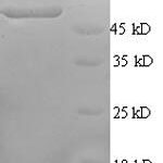 SDS-PAGE separation of QP5752 followed by commassie total protein stain results in a primary band consistent with reported data for CAMK4 / CaMKIV. These data demonstrate Greater than 90% as determined by SDS-PAGE.