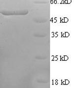 SDS-PAGE separation of QP5752 followed by commassie total protein stain results in a primary band consistent with reported data for CAMK4 / CaMKIV. These data demonstrate Greater than 90% as determined by SDS-PAGE.