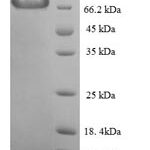 SDS-PAGE separation of QP5755 followed by commassie total protein stain results in a primary band consistent with reported data for Calpain-1 catalytic subunit. These data demonstrate Greater than 90% as determined by SDS-PAGE.