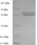 SDS-PAGE separation of QP5763 followed by commassie total protein stain results in a primary band consistent with reported data for Caspase-5. These data demonstrate Greater than 90% as determined by SDS-PAGE.