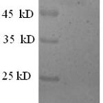 SDS-PAGE separation of QP5764 followed by commassie total protein stain results in a primary band consistent with reported data for Extracellular calcium-sensing receptor. These data demonstrate Greater than 90% as determined by SDS-PAGE.