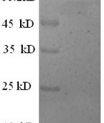 SDS-PAGE separation of QP5764 followed by commassie total protein stain results in a primary band consistent with reported data for Extracellular calcium-sensing receptor. These data demonstrate Greater than 90% as determined by SDS-PAGE.