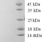 SDS-PAGE separation of QP5765 followed by commassie total protein stain results in a primary band consistent with reported data for Calpastatin. These data demonstrate Greater than 90% as determined by SDS-PAGE.