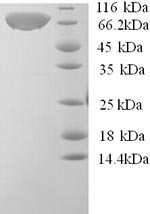 SDS-PAGE separation of QP5765 followed by commassie total protein stain results in a primary band consistent with reported data for Calpastatin. These data demonstrate Greater than 90% as determined by SDS-PAGE.