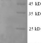 SDS-PAGE separation of QP5767 followed by commassie total protein stain results in a primary band consistent with reported data for Cystathionine beta-synthase. These data demonstrate Greater than 90% as determined by SDS-PAGE.