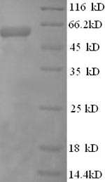 SDS-PAGE separation of QP5767 followed by commassie total protein stain results in a primary band consistent with reported data for Cystathionine beta-synthase. These data demonstrate Greater than 90% as determined by SDS-PAGE.