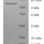 SDS-PAGE separation of QP5768 followed by commassie total protein stain results in a primary band consistent with reported data for Cystathionine beta-synthase. These data demonstrate Greater than 90% as determined by SDS-PAGE.