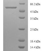 SDS-PAGE separation of QP5768 followed by commassie total protein stain results in a primary band consistent with reported data for Cystathionine beta-synthase. These data demonstrate Greater than 90% as determined by SDS-PAGE.