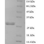 SDS-PAGE separation of QP5771 followed by commassie total protein stain results in a primary band consistent with reported data for CCL16 / HCC-4 / NCC4. These data demonstrate Greater than 90% as determined by SDS-PAGE.