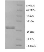 SDS-PAGE separation of QP5771 followed by commassie total protein stain results in a primary band consistent with reported data for CCL16 / HCC-4 / NCC4. These data demonstrate Greater than 90% as determined by SDS-PAGE.