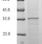 SDS-PAGE separation of QP5772 followed by commassie total protein stain results in a primary band consistent with reported data for CCL20 / MIP-3 alpha. These data demonstrate Greater than 90% as determined by SDS-PAGE.