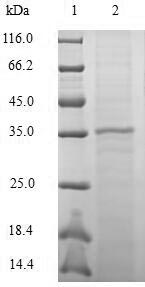 SDS-PAGE separation of QP5772 followed by commassie total protein stain results in a primary band consistent with reported data for CCL20 / MIP-3 alpha. These data demonstrate Greater than 90% as determined by SDS-PAGE.