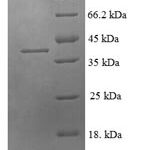 SDS-PAGE separation of QP5773 followed by commassie total protein stain results in a primary band consistent with reported data for CCL21 / 6Ckine. These data demonstrate Greater than 90% as determined by SDS-PAGE.