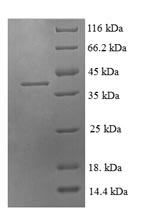 SDS-PAGE separation of QP5773 followed by commassie total protein stain results in a primary band consistent with reported data for CCL21 / 6Ckine. These data demonstrate Greater than 90% as determined by SDS-PAGE.