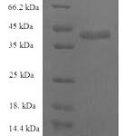 SDS-PAGE separation of QP5774 followed by commassie total protein stain results in a primary band consistent with reported data for C-C motif chemokine 25. These data demonstrate Greater than 90% as determined by SDS-PAGE.