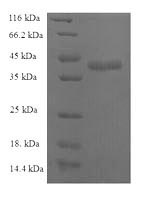 SDS-PAGE separation of QP5774 followed by commassie total protein stain results in a primary band consistent with reported data for C-C motif chemokine 25. These data demonstrate Greater than 90% as determined by SDS-PAGE.