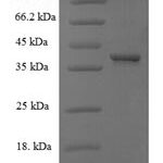 SDS-PAGE separation of QP5776 followed by commassie total protein stain results in a primary band consistent with reported data for Cyclin D1. These data demonstrate Greater than 90% as determined by SDS-PAGE.