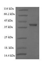 SDS-PAGE separation of QP5776 followed by commassie total protein stain results in a primary band consistent with reported data for Cyclin D1. These data demonstrate Greater than 90% as determined by SDS-PAGE.