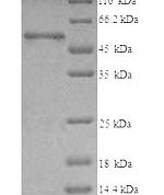SDS-PAGE separation of QP5779 followed by commassie total protein stain results in a primary band consistent with reported data for T-complex protein 1 subunit beta. These data demonstrate Greater than 90% as determined by SDS-PAGE.