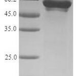 SDS-PAGE separation of QP5780 followed by commassie total protein stain results in a primary band consistent with reported data for T-complex protein 1 subunit zeta. These data demonstrate Greater than 90% as determined by SDS-PAGE.