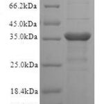 SDS-PAGE separation of QP5783 followed by commassie total protein stain results in a primary band consistent with reported data for T-cell surface glycoprotein CD1c. These data demonstrate Greater than 90% as determined by SDS-PAGE.