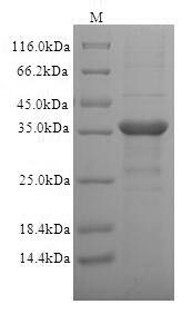 SDS-PAGE separation of QP5783 followed by commassie total protein stain results in a primary band consistent with reported data for T-cell surface glycoprotein CD1c. These data demonstrate Greater than 90% as determined by SDS-PAGE.
