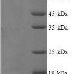 SDS-PAGE separation of QP5788 followed by commassie total protein stain results in a primary band consistent with reported data for CD44 / HCAM. These data demonstrate Greater than 90% as determined by SDS-PAGE.