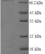 SDS-PAGE separation of QP5788 followed by commassie total protein stain results in a primary band consistent with reported data for CD44 / HCAM. These data demonstrate Greater than 90% as determined by SDS-PAGE.