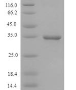 SDS-PAGE separation of QP5789 followed by commassie total protein stain results in a primary band consistent with reported data for CD46. These data demonstrate Greater than 90% as determined by SDS-PAGE.