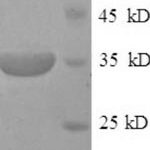 SDS-PAGE separation of QP5790 followed by commassie total protein stain results in a primary band consistent with reported data for CD46. These data demonstrate Greater than 90% as determined by SDS-PAGE.