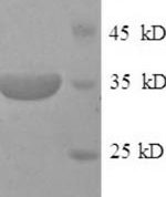 SDS-PAGE separation of QP5790 followed by commassie total protein stain results in a primary band consistent with reported data for CD46. These data demonstrate Greater than 90% as determined by SDS-PAGE.