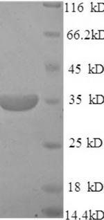 SDS-PAGE separation of QP5790 followed by commassie total protein stain results in a primary band consistent with reported data for CD46. These data demonstrate Greater than 90% as determined by SDS-PAGE.