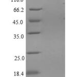 SDS-PAGE separation of QP5791 followed by commassie total protein stain results in a primary band consistent with reported data for CD59 / CD59A / MAC-IP. These data demonstrate Greater than 90% as determined by SDS-PAGE.