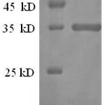 SDS-PAGE separation of QP5798 followed by commassie total protein stain results in a primary band consistent with reported data for CD81 / TAPA-1. These data demonstrate Greater than 90% as determined by SDS-PAGE.