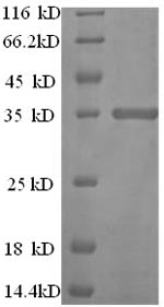 SDS-PAGE separation of QP5798 followed by commassie total protein stain results in a primary band consistent with reported data for CD81 / TAPA-1. These data demonstrate Greater than 90% as determined by SDS-PAGE.