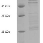 SDS-PAGE separation of QP5803 followed by commassie total protein stain results in a primary band consistent with reported data for E-Cadherin / CD324. These data demonstrate Greater than 90% as determined by SDS-PAGE.