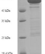 SDS-PAGE separation of QP5803 followed by commassie total protein stain results in a primary band consistent with reported data for E-Cadherin / CD324. These data demonstrate Greater than 90% as determined by SDS-PAGE.