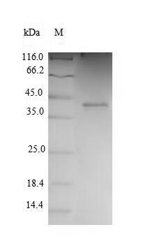 SDS-PAGE separation of QP5804 followed by commassie total protein stain results in a primary band consistent with reported data for CDK2 / p33. These data demonstrate Greater than 90% as determined by SDS-PAGE.