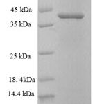 SDS-PAGE separation of QP5805 followed by commassie total protein stain results in a primary band consistent with reported data for CDK2AP1. These data demonstrate Greater than 90% as determined by SDS-PAGE.