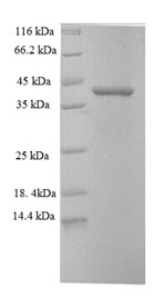 SDS-PAGE separation of QP5805 followed by commassie total protein stain results in a primary band consistent with reported data for CDK2AP1. These data demonstrate Greater than 90% as determined by SDS-PAGE.