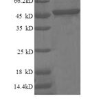 SDS-PAGE separation of QP5807 followed by commassie total protein stain results in a primary band consistent with reported data for p21WAF1. These data demonstrate Greater than 90% as determined by SDS-PAGE.