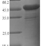 SDS-PAGE separation of QP5813 followed by commassie total protein stain results in a primary band consistent with reported data for CEACAM6. These data demonstrate Greater than 90% as determined by SDS-PAGE.