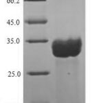 SDS-PAGE separation of QP5820 followed by commassie total protein stain results in a primary band consistent with reported data for CETN2 / Centrin 2. These data demonstrate Greater than 90% as determined by SDS-PAGE.