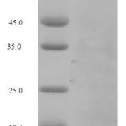 SDS-PAGE separation of QP5822 followed by commassie total protein stain results in a primary band consistent with reported data for complement factor B. These data demonstrate Greater than 90% as determined by SDS-PAGE.