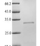 SDS-PAGE separation of QP5823 followed by commassie total protein stain results in a primary band consistent with reported data for Adipsin / Complement Factor D / CFD. These data demonstrate Greater than 82.10% as determined by SDS-PAGE.