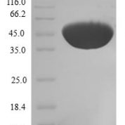 SDS-PAGE separation of QP5825 followed by commassie total protein stain results in a primary band consistent with reported data for CFL2 / cofilin 2 / ADF. These data demonstrate Greater than 80% as determined by SDS-PAGE.