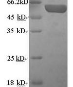 SDS-PAGE separation of QP5827 followed by commassie total protein stain results in a primary band consistent with reported data for Chromogranin A. These data demonstrate Greater than 90% as determined by SDS-PAGE.